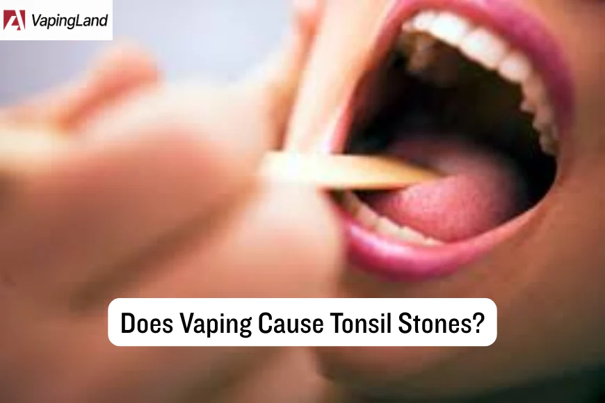 does vaping cause tonsil stones